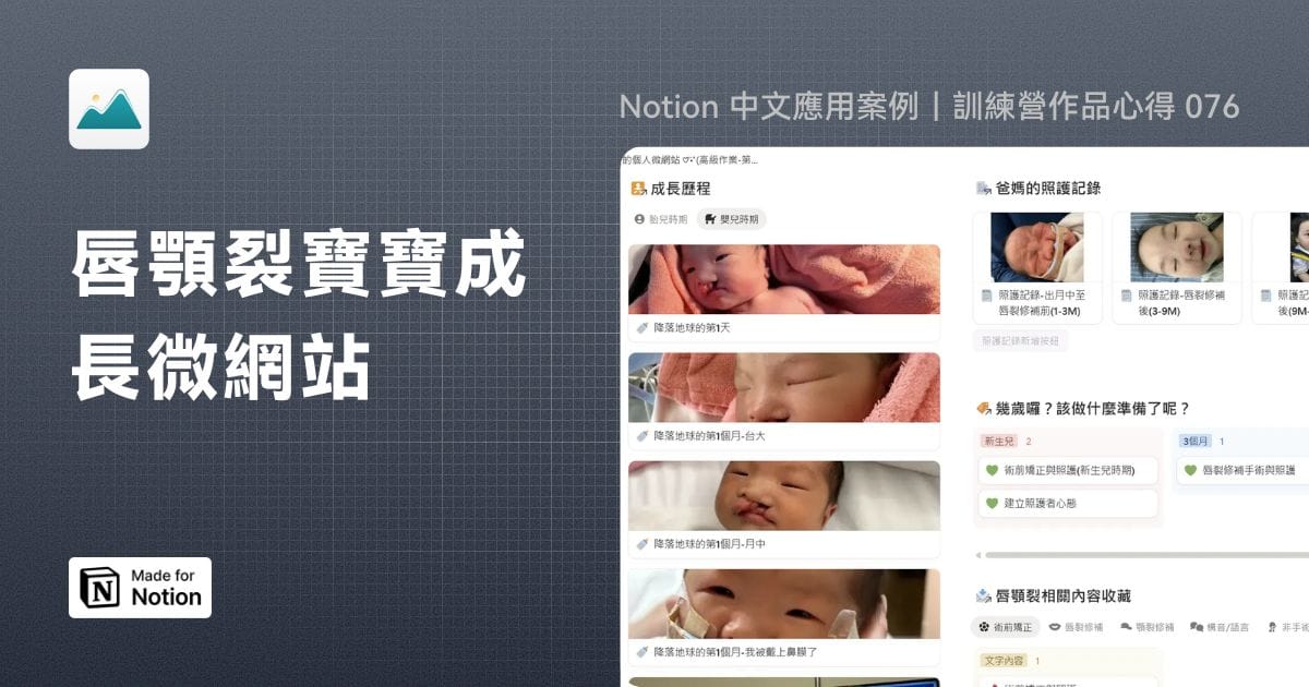 【Notion 中文應用案例】唇顎裂寶寶成長微網站｜訓練營作品心得 076